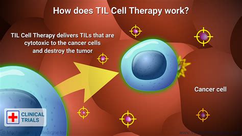 til cell therapy for melanoma